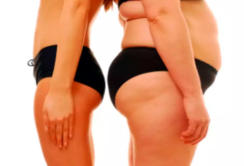 Genética x obesidade: ela não te define